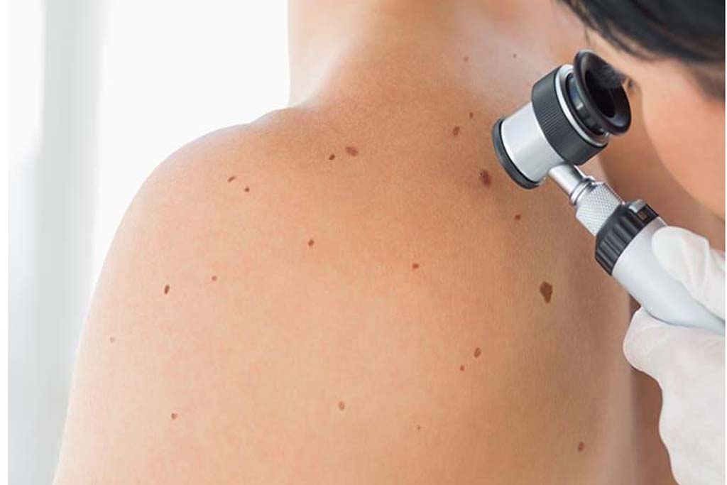 Dermatology Department