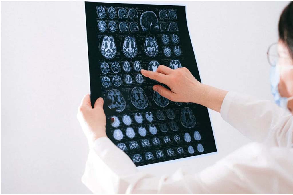 Neurology Services